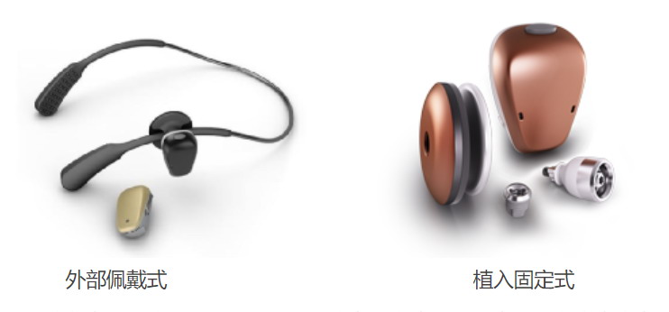 骨传导与气传导到底有什么不同? 20220610020226292